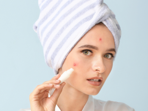 How to Remove Pimples Naturally and Effectively